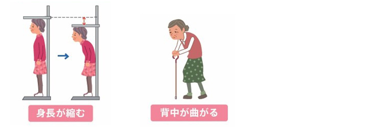 身長が縮む 背中が曲がる