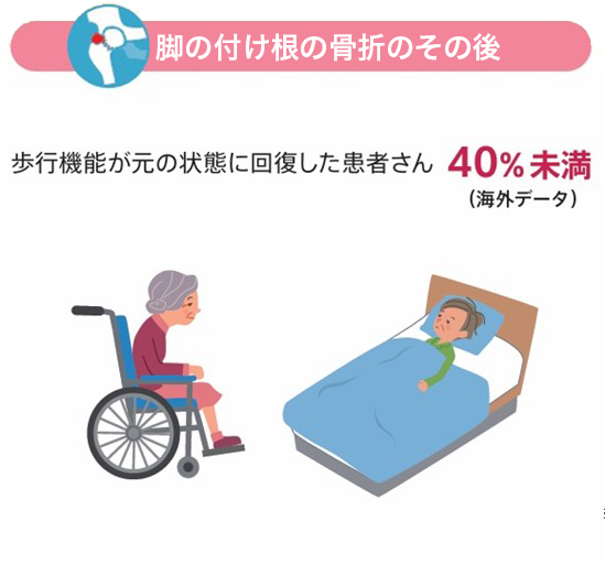 脚の付け根の骨折のその後